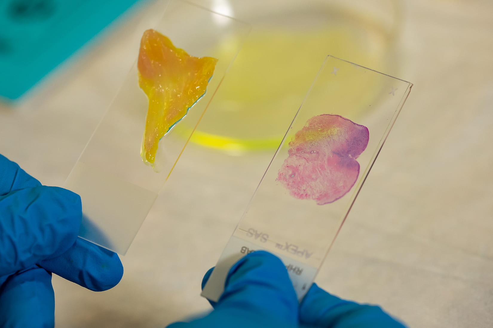 A research holds two slides, one with a yellow sample, the other with a pink sample