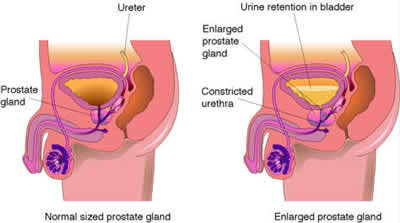Masturbation prostate study